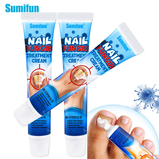 CREMA PARA EL TRATAMIENTO DE HONGOS EN LAS UÑAS